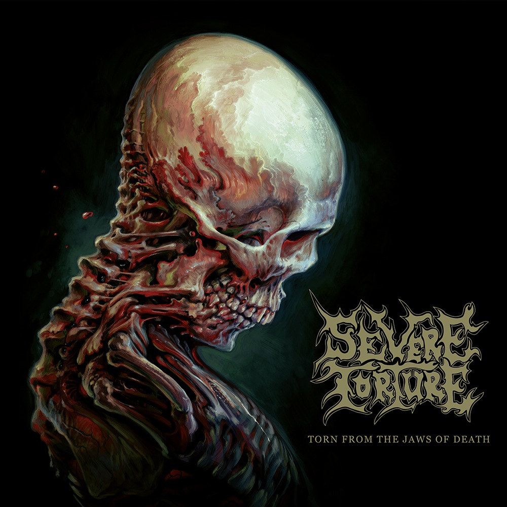 Torn From The Jaws Of Death - Severe Torture