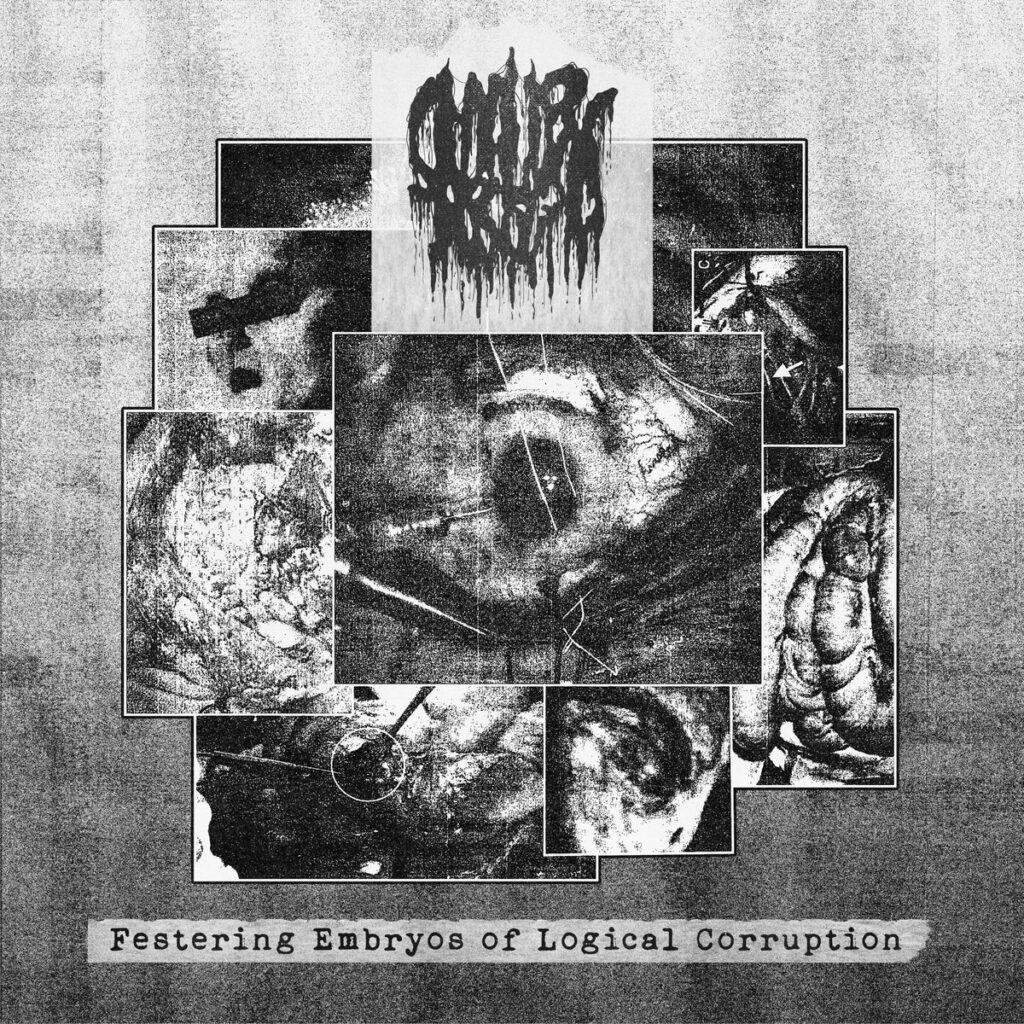 Festering Embryos Of Logical Corruption - Smallpox Aroma